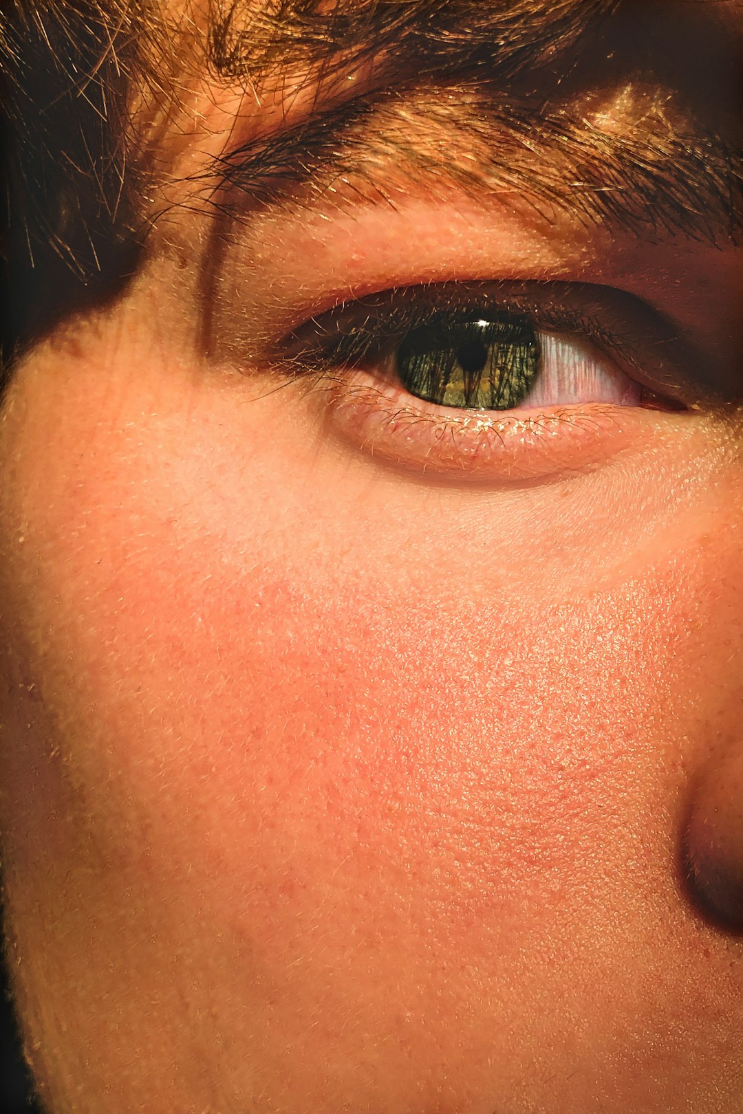 Even skin tone texture for pigmentation correction section